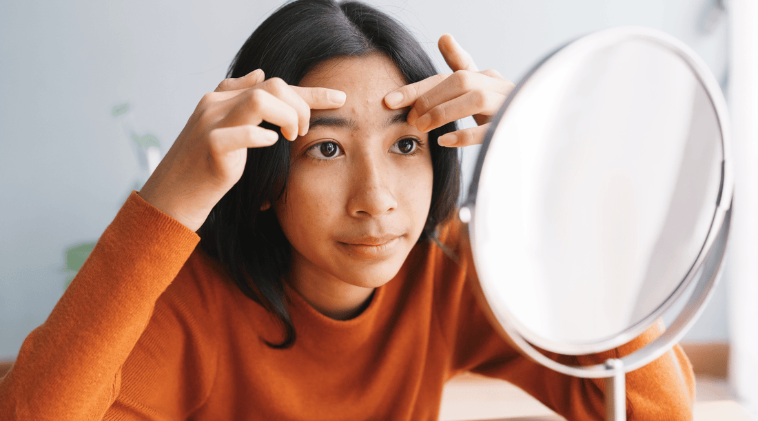 Young woman with acne pimples examining her skin in the mirror