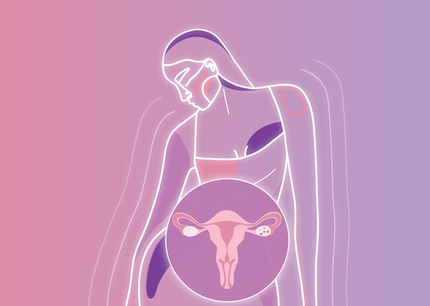 Taking the Stress Out of PCOS: Working Beyond a Diagnosis